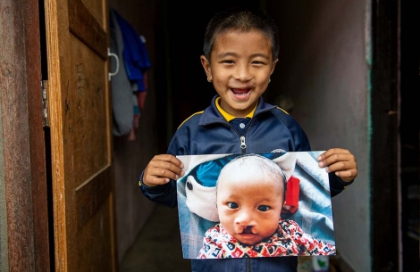 Jenious at his home holding an image of himself before cleft surgery