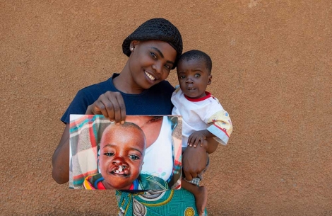 Samson's mom hold an image of Samson before cleft surgery