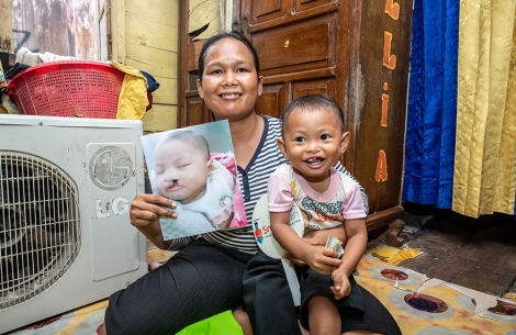 Karina and her mother, who holds a picture of her before her cleft surgery. 