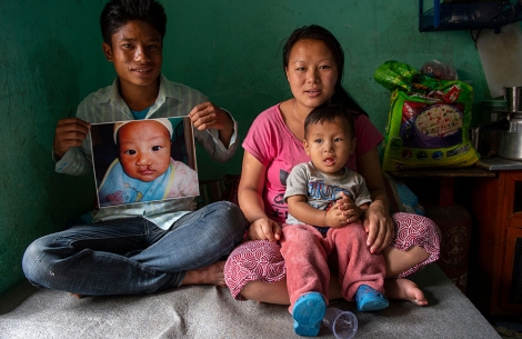 Smile Train patient Smile Rai with his parents, who are holding a picture of him before his free cleft surgery in Nepal