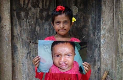 Disha smiling and holding a photo of herself before cleft surgery