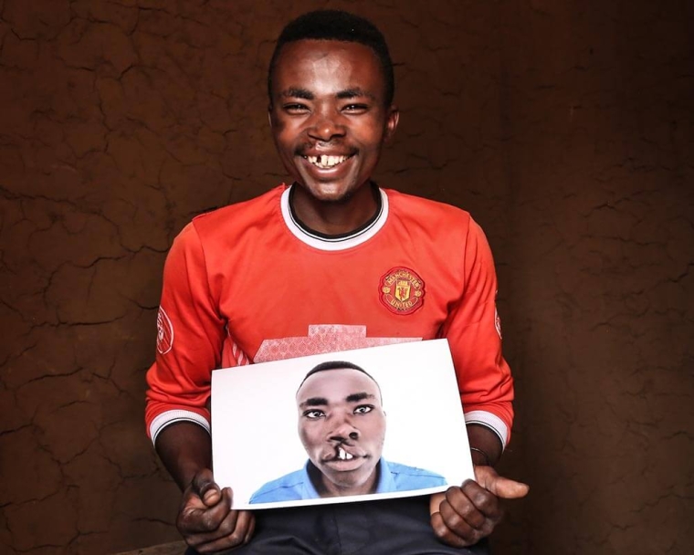 Claude holds image of himself before cleft surgery